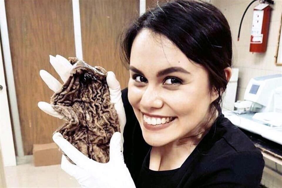 Anteriormente, una de las jóvenes mostró en Instagram otro órgano humano.