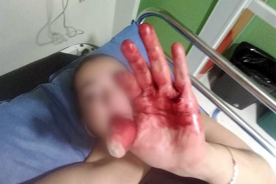 Italia Krystal, quien perdió un dedo al ser atacada, teme ser asesinada por su esposo; la víctima ha interpuesta 12 denuncias en 3 años.