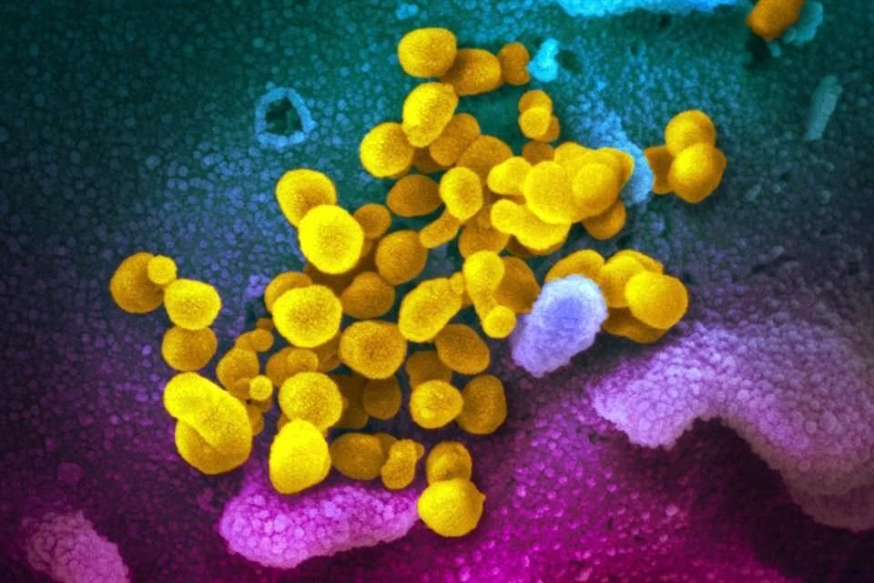 Imagen microscópica del nuevo tipo de coronavirus, Covid-19, obtenida por el Instituto Nacional de Salud de EU.