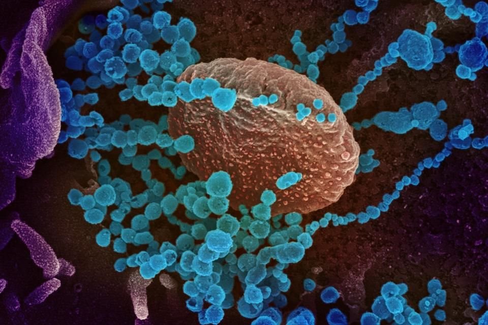 Una segunda muestra por coronavirus ya se analiza.