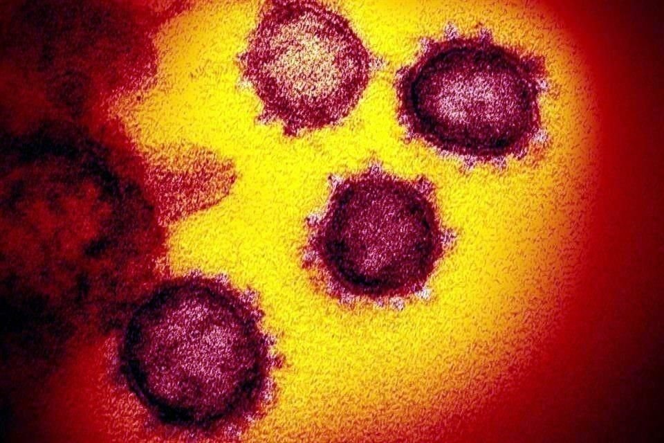 En la investigación, que durará seis meses, se analizan 250 personas con coronavirus, otro de los descubrimientos es que es un virus más estable, comparado con el de la influenza.