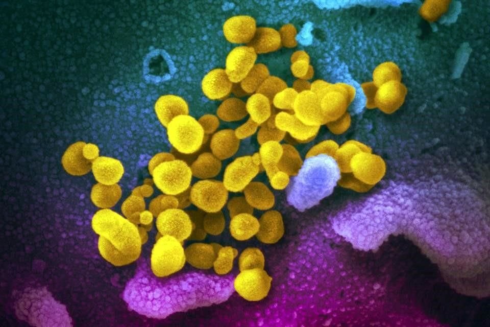 Una imagen de un microscopio electrónico del SARS-Cov-2, coronavirus que causa el Covid-19.