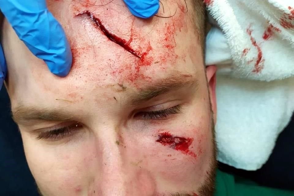 La herida que dejó sobre la frente del portero.