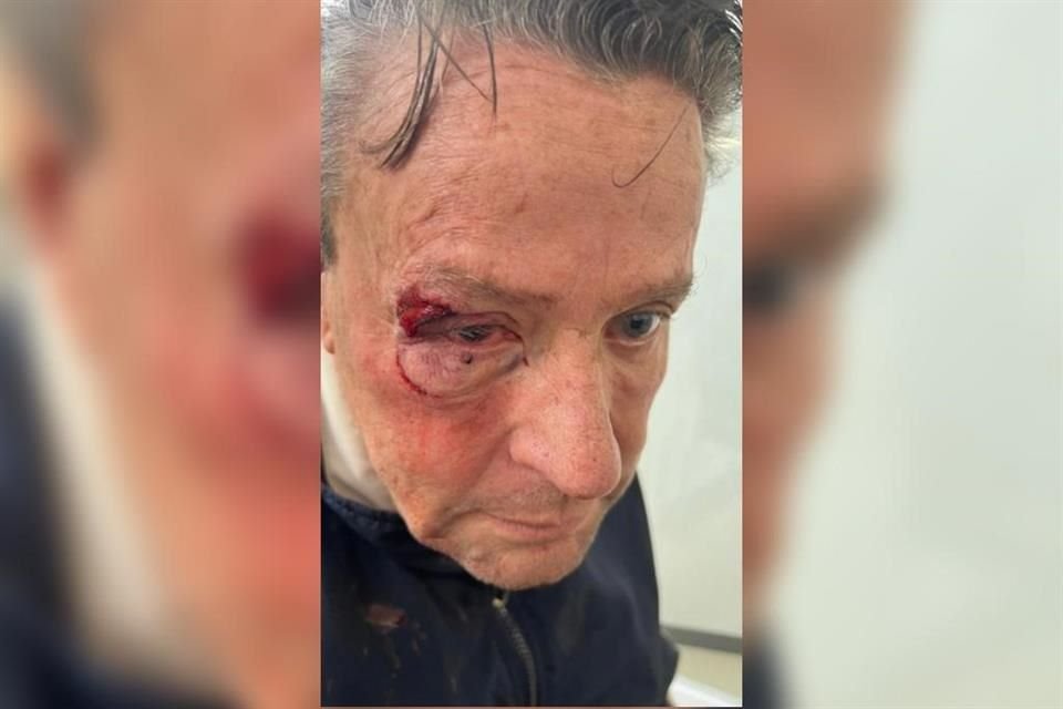 Alfredo Adame fue golpeado por sujetos desconocidos, pues vive a unos metros de distancia y salió para auxiliar a los lesionados.