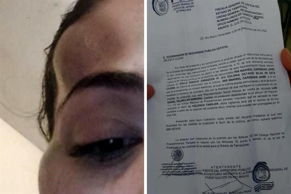 La esposa del político hizo esta tarde la denuncia de hechos al presentarse con hematomas en la cabeza y en el rostro.