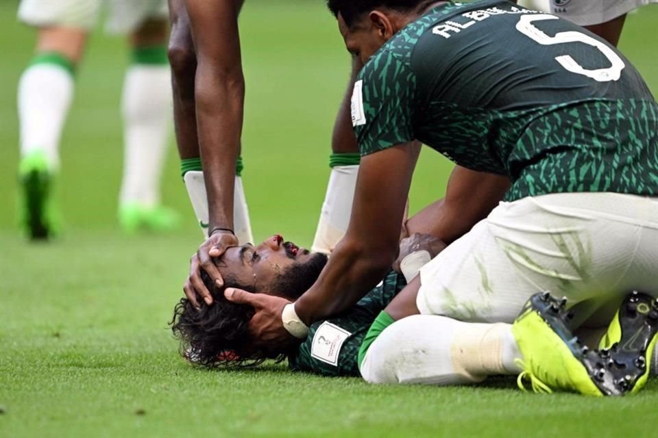 El zaguero Yasser Al-Shahrani sufrió fractura de mandíbula, hendidura de huesos faciales y una hemorragia interna.