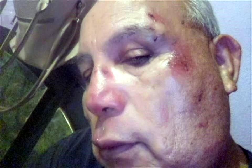 Entrevistado esta mañana vía telefónica, el vigilante aseguró que se sorprendió por el comportamiento del residente.