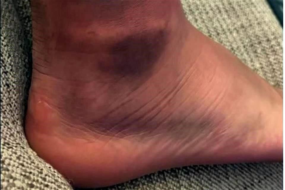 El delantero Rogelio Funes Mori mostró su lesión a través de Instagram.