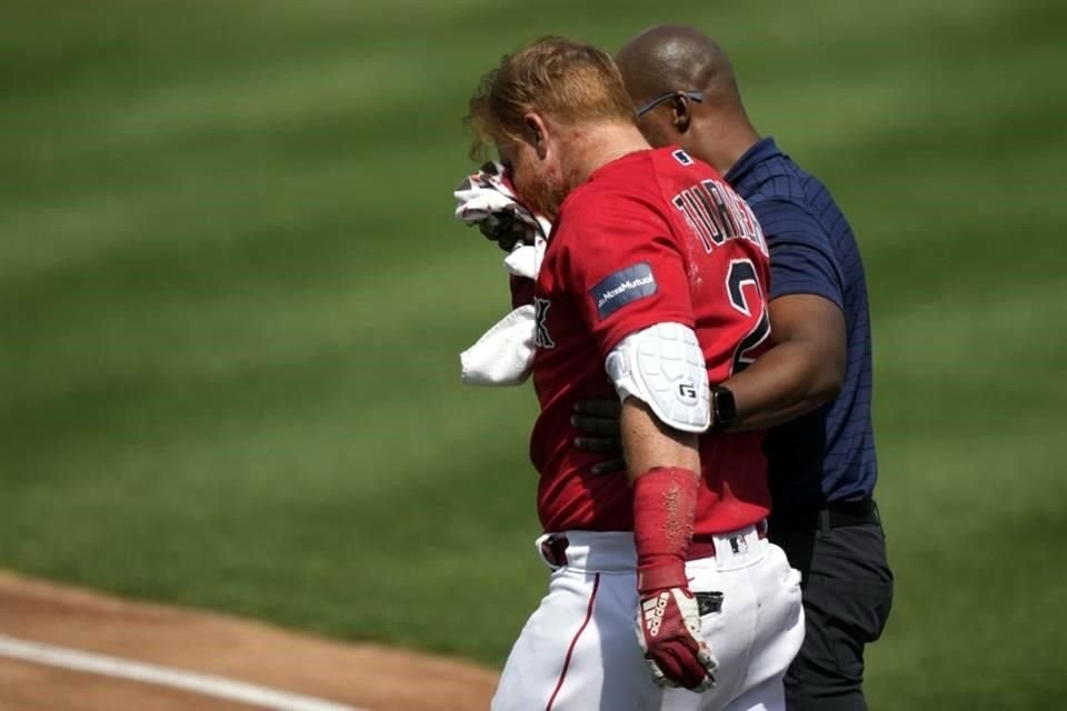 Justin Turner abandonó el juego ante los Tigers por un pelotazo en el rostro.