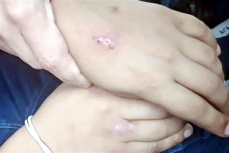 Los niños mostraron heridas que atribuyeron a un enfermero del DIF Capullos.