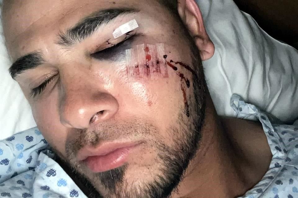 El pelotero cubano agradeció el apoyo en redes sociales.