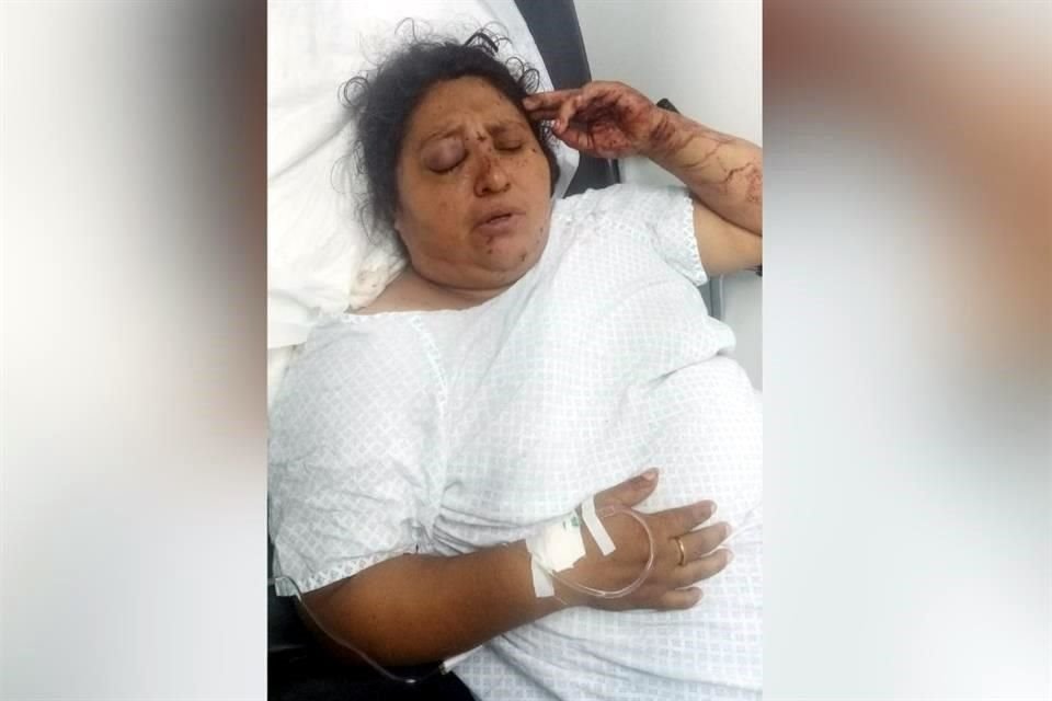 Dalila Llanos Santiago resulta herida por un impacto de bala, presuntamente originado por militares.