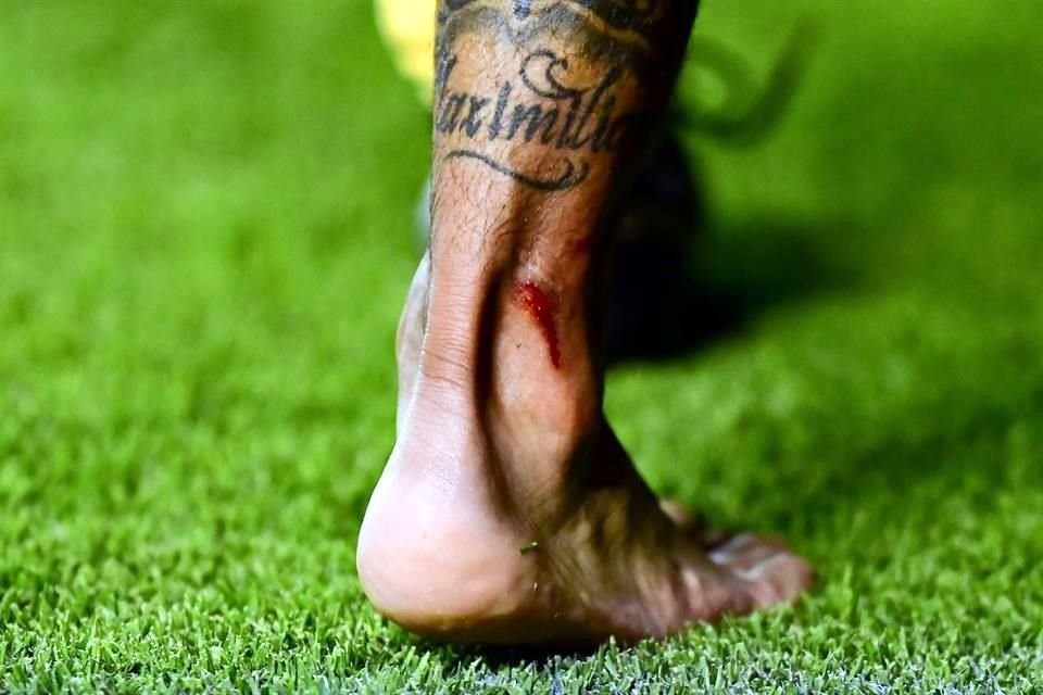 Luis 'Chaka' Rodríguez dejó la cancha con esta cortada en su pie derecho.