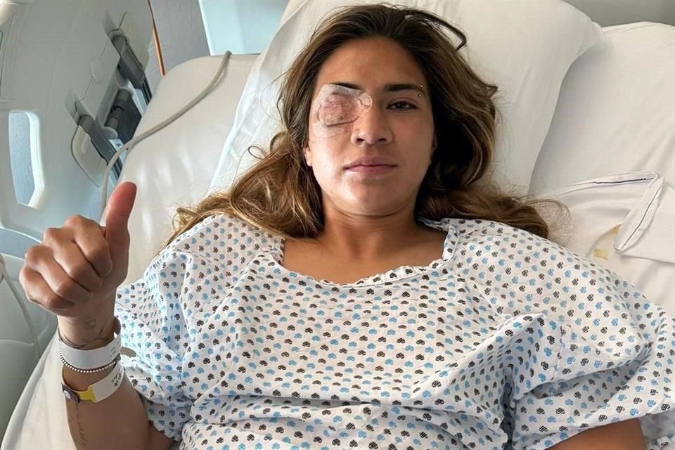 Nayeli Rangel, tras la operación realizada en un hospital en Puebla.