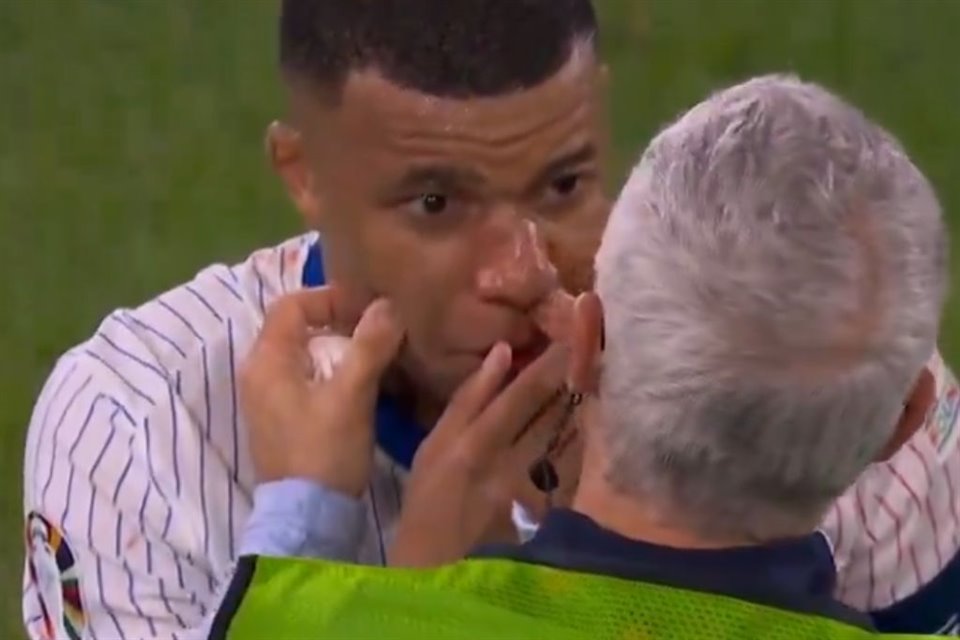 El atacante francés Kylian Mbappé resultó con una fractura en la nariz durante el duelo de la Euro entre Francia y Austria.