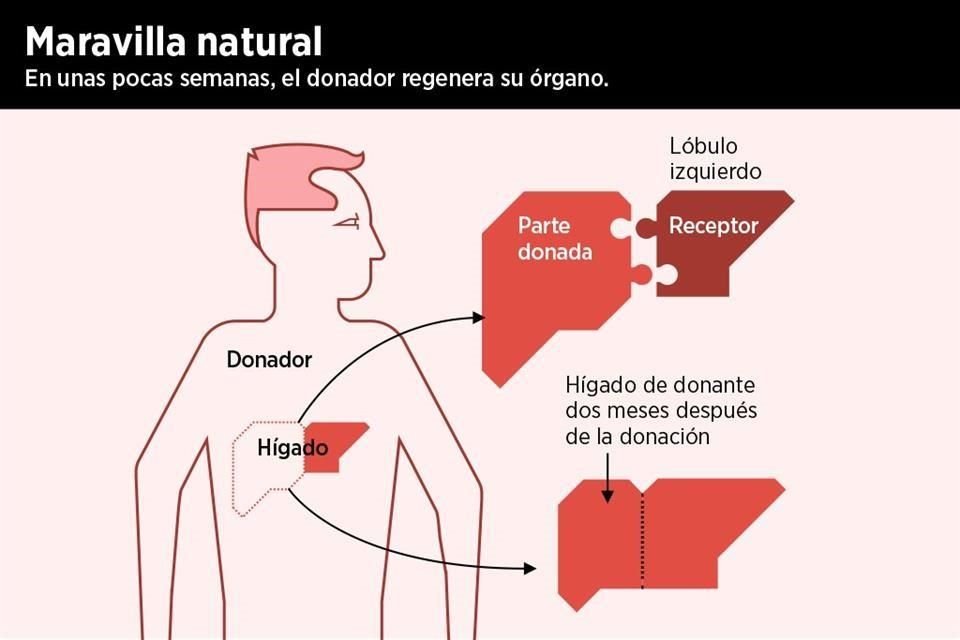 Entre los beneficios de esta forma de trasplante está el que las personas que reciben parte del hígado de un donante vivo suelen tener mejores índices de supervivencia a corto plazo.