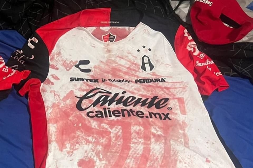 Gerardo Soria denunció en redes sociales la agresión y mostró imágenes de sus lesiones y su playera ensangrentada.