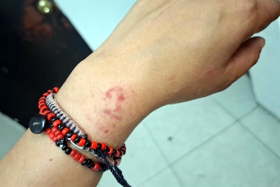 Presuntamente el agresor se abalanzó contra la oficial, golpeándola en los brazos, por lo que tuvo que ser sometido y detenido por otros uniformados.