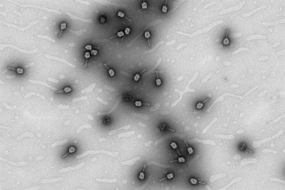 Algunas bacterias ya no se eliminan fácilmente con los tratamientos antibióticos habituales. Científicos las combaten con bacteriófagos.