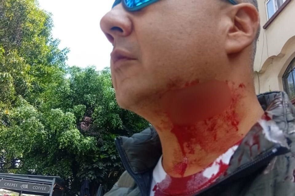 'Pacorvette' fue trasladado a un hospital para ser atendido por la lesión.