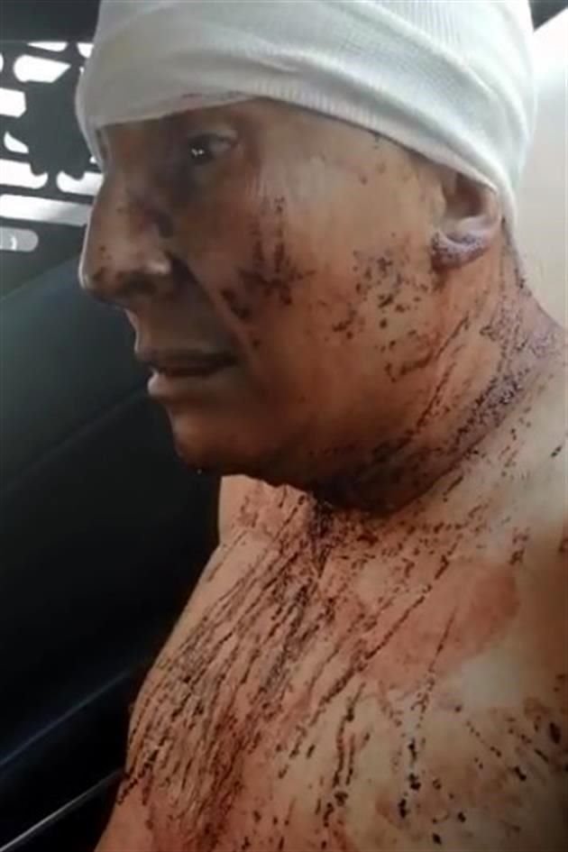 La ex diputada aseguró que, el amenazar con un suicidio, podría ser señal de manipulación del imputado y no de una intención real.