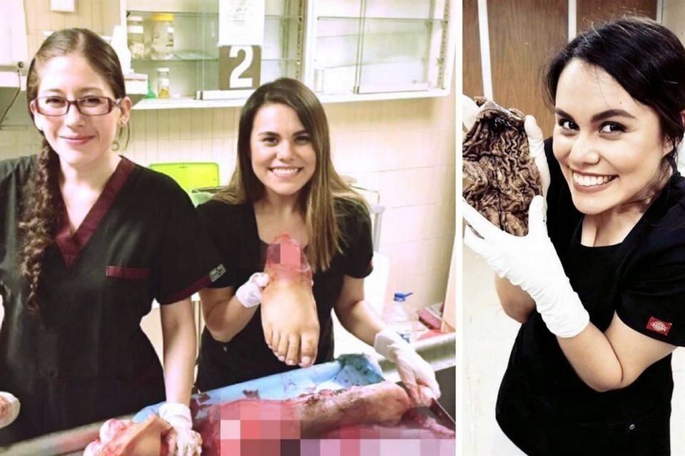 La fotografa de las dos residentes con la pierna amputada a un paciente fue publicada en Twitter; anteriormente, una de las jvenes mostr en Instagram otro rgano humano.