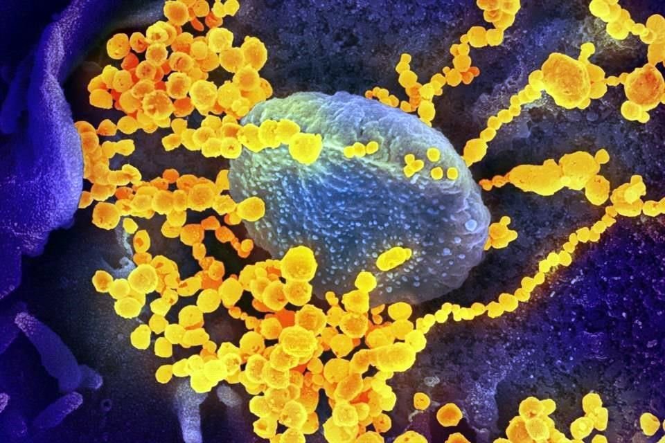 Fotografía cedida por el Instituto Nacional de Alergias y Enfermedades Infecciosas de EU de una imagen de microscopio electrónico que muestra al SARS-CoV-2.