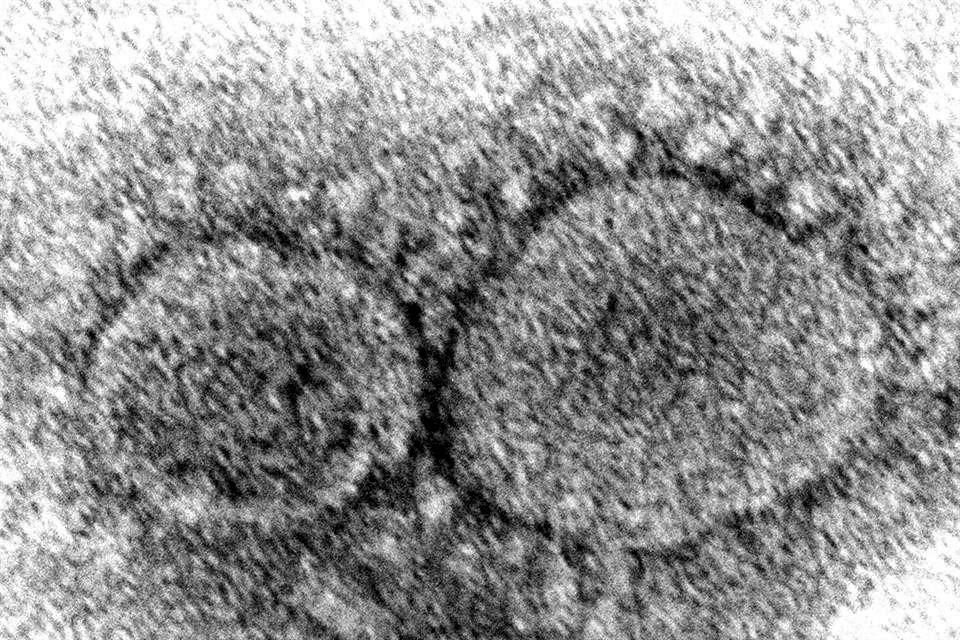 Partículas del virus SAR-CoV-2 que causa la Covid-19.