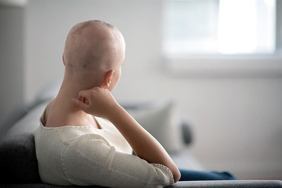 La alopecia se produce cuando el sistema inmune ataca los folículos pilosos y provoca pérdida de cabello.