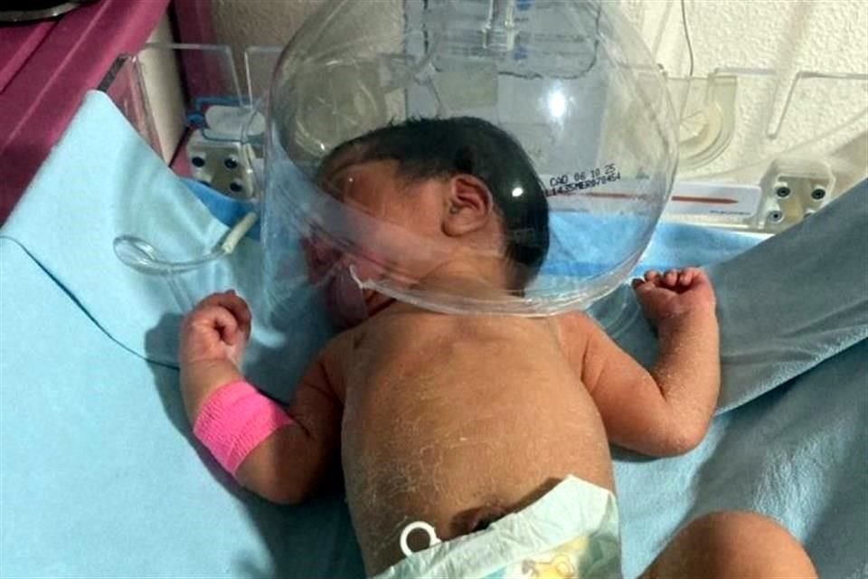 Las investigaciones buscan esclarecer si existió desabasto del insumo para atender al bebé.